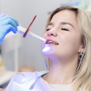 Limpieza Dental Profesional